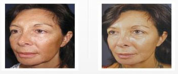 best-facials-in-woodland-hills.png