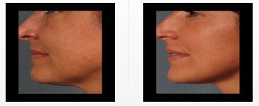 best-skin-care-los-angeles.png