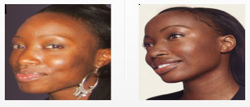 low-price-facials-woodland-hills.png