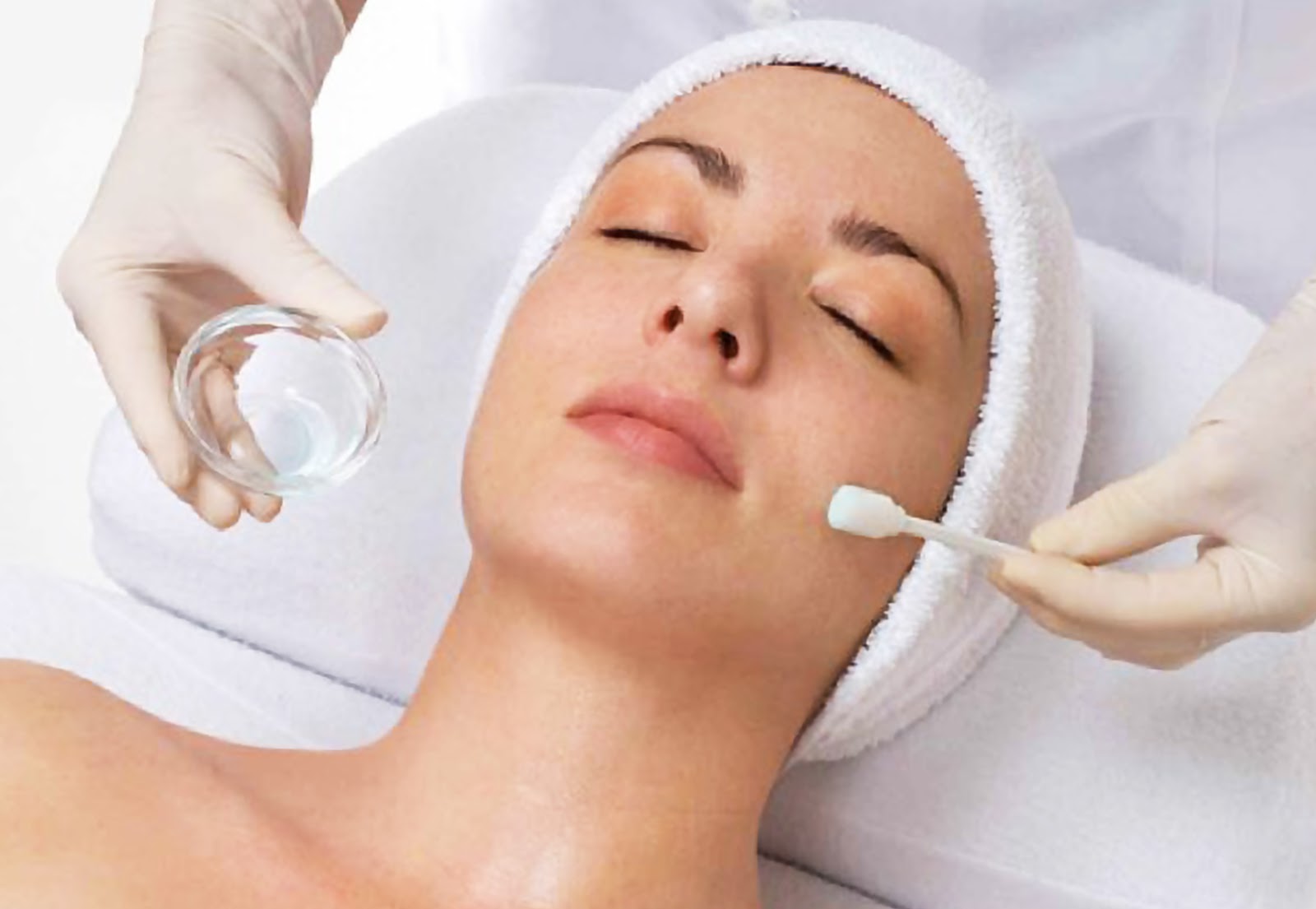 chemical-peel.jpg